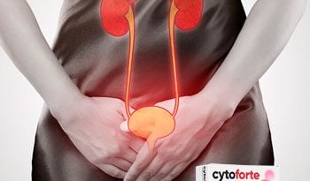 Цитофорте – комплекс для женщин от цистита