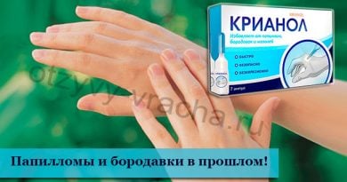 Крианол для лечения папиллом