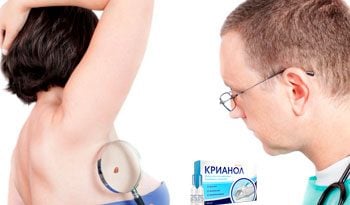 Крианол – гель для наружного применения от папиллом