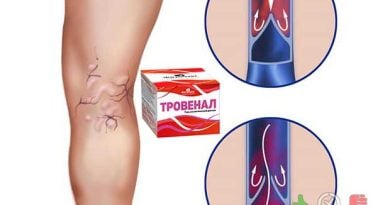 Тровенал – гель от варикоза
