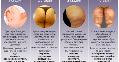 Крем Антицеллюлит Extreme Антицеллюлит Экстрем от целлюлита — позвольте себе идеальную фигуру