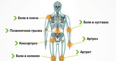 Triartron Dobrovit — крем с гиалуроновой кислотой для восстановления суставов