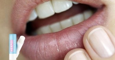 Herpes NanoGen — избавьтесь от надоедливого герпеса раз и навсегда!