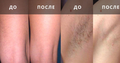 Спрей для удаления волос Kingyes Silky Beauty Spray, отзывы