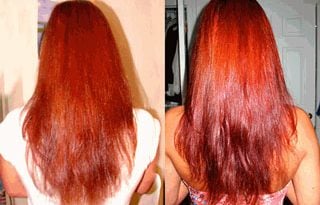 Yuda Pilatory — эффективное лечение алопеции
